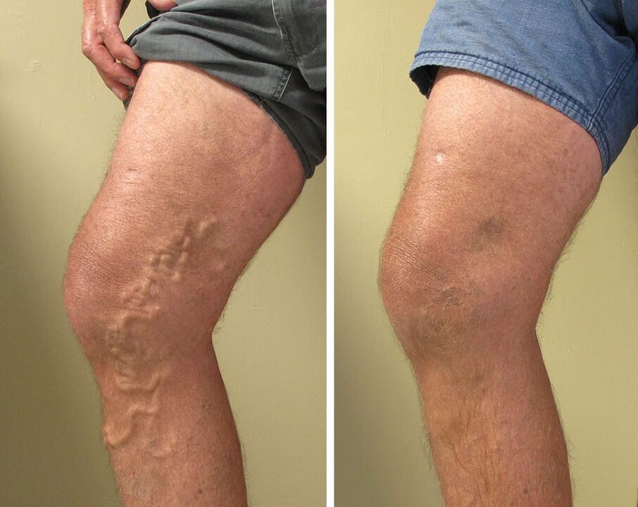 Experience with the use of gel zxcvbnmqwert