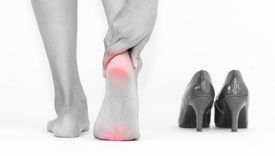 The cause of varicose veins is uncomfortable shoes